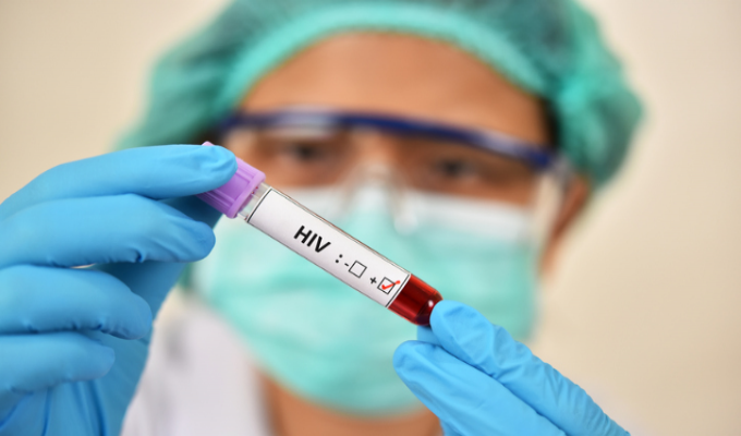 Quase 700 mil brasileiros estão em tratamento antirretroviral contra o HIV