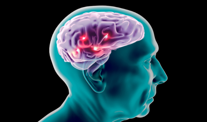 Canabidiol diminui tumor no cérebro altamente agressivo, sugere estudo