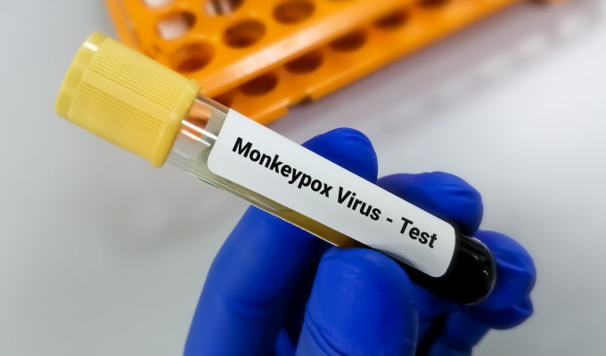 Antiviral pode ser eficaz contra sintomas da varíola dos macacos, aponta estudo