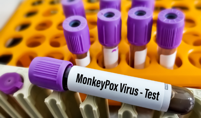 Anvisa avalia pedidos de registro para testes da varíola dos macacos